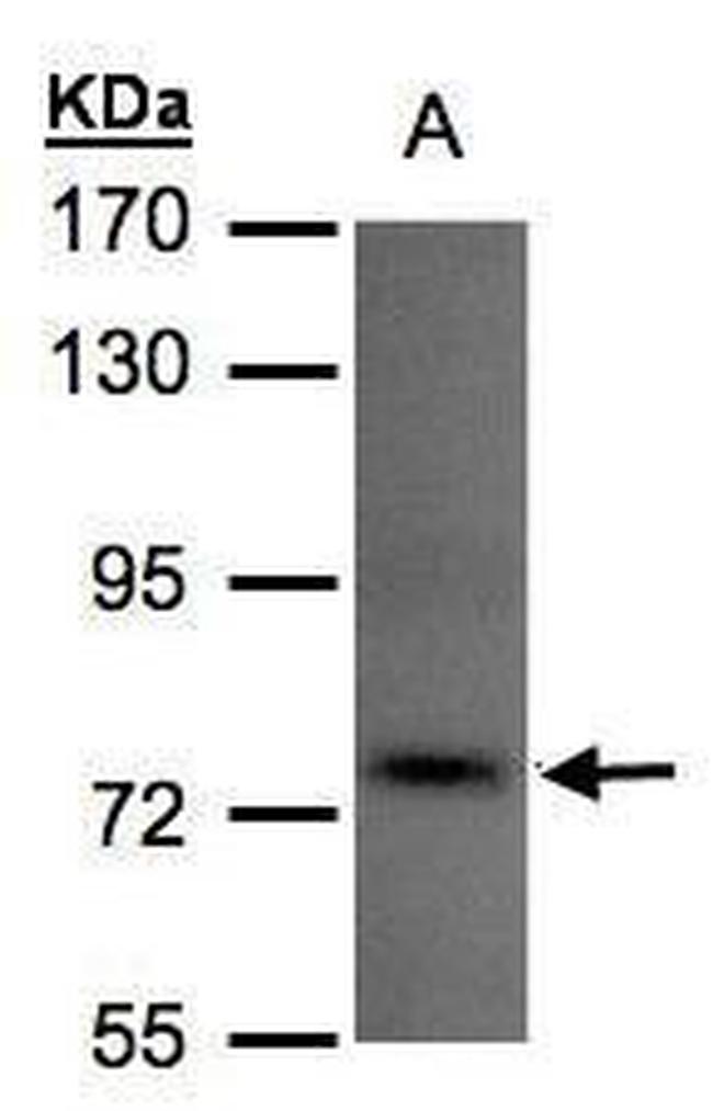 TLK1 Antibody in Western Blot (WB)