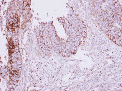 MCC Antibody in Immunohistochemistry (Paraffin) (IHC (P))