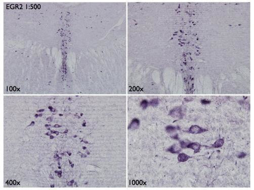 EGR2 Antibody in Immunohistochemistry (Frozen) (IHC (F))