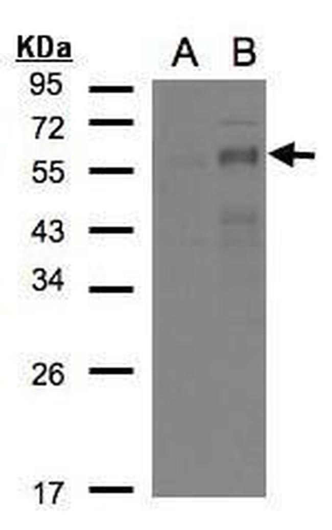 EGR2 Antibody in Western Blot (WB)