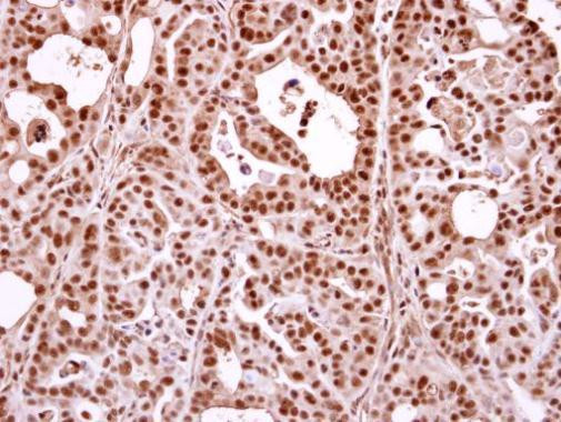 Nuclear Matrix Protein p84 Antibody in Immunohistochemistry (Paraffin) (IHC (P))