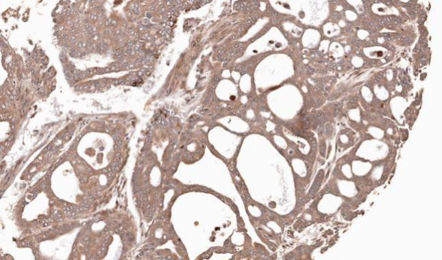 MMP12 Antibody in Immunohistochemistry (Paraffin) (IHC (P))