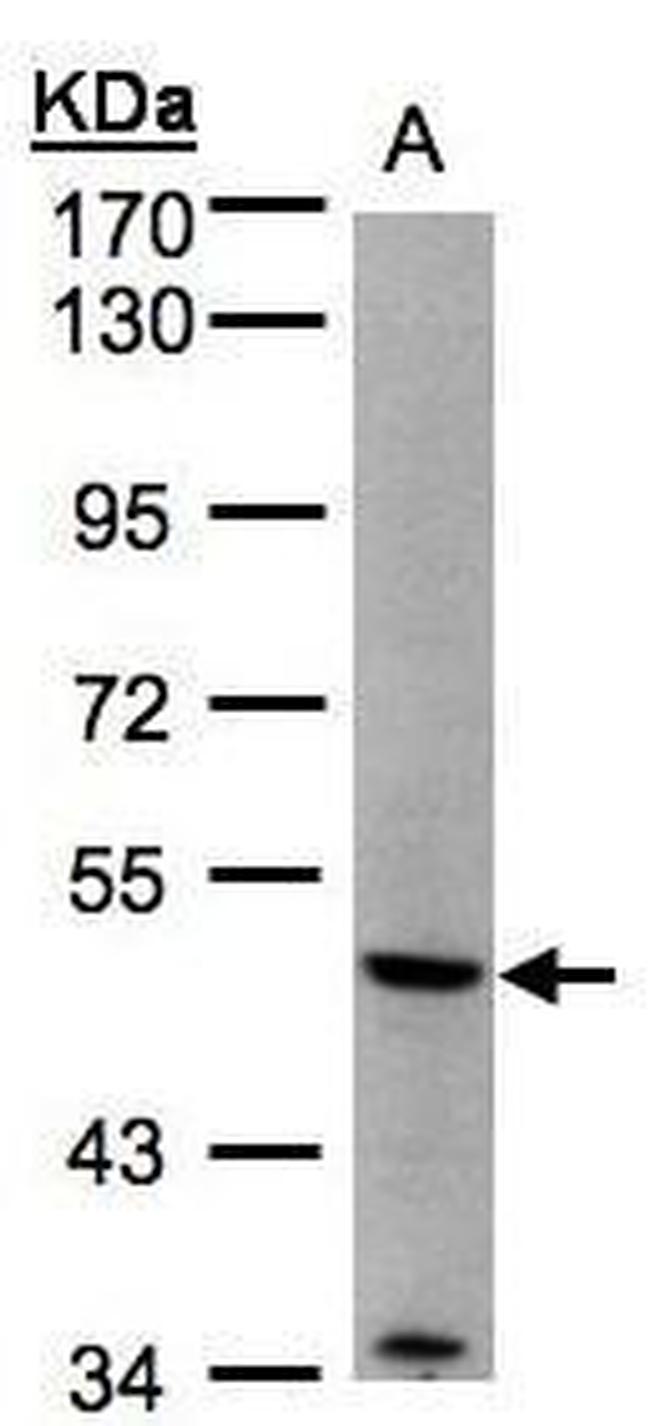 MMP12 Antibody in Western Blot (WB)