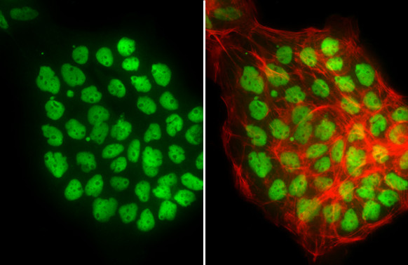 p53 Antibody in Immunocytochemistry (ICC/IF)