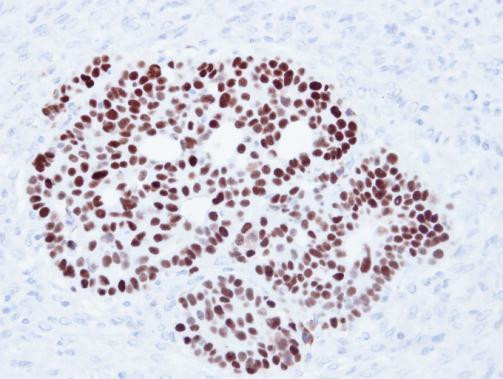 p53 Antibody in Immunohistochemistry (Paraffin) (IHC (P))