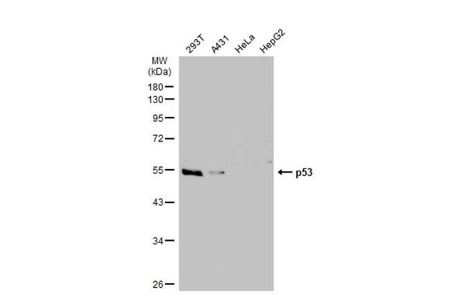 p53 Antibody in Western Blot (WB)