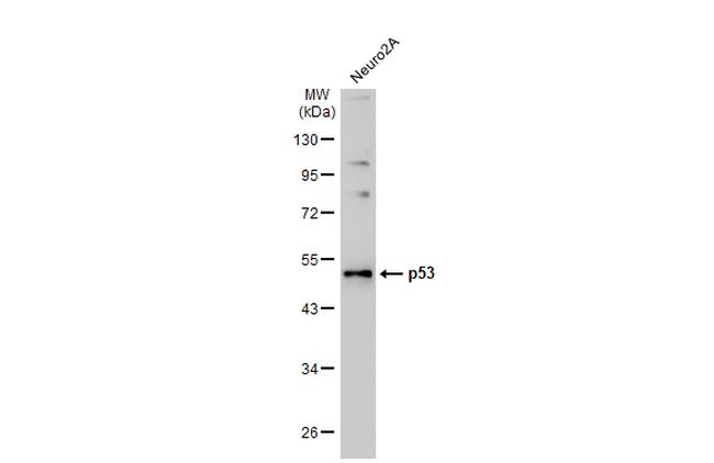 p53 Antibody in Western Blot (WB)