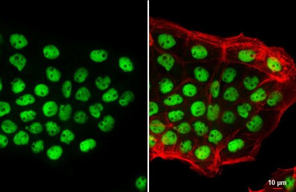 p53 Antibody in Immunocytochemistry (ICC/IF)