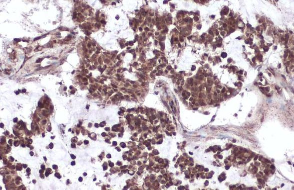 p53 Antibody in Immunohistochemistry (Paraffin) (IHC (P))