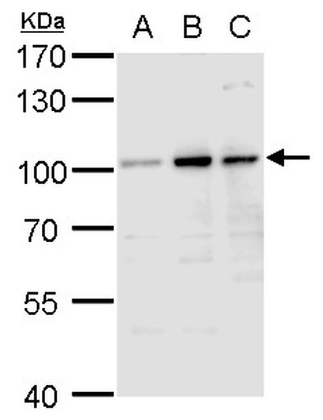 Aconitase 1 Antibody in Western Blot (WB)