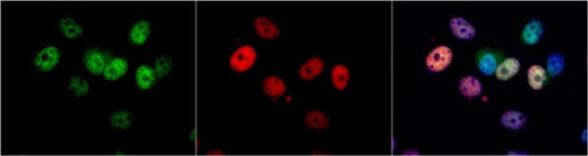 CDK4 Antibody in Immunocytochemistry (ICC/IF)