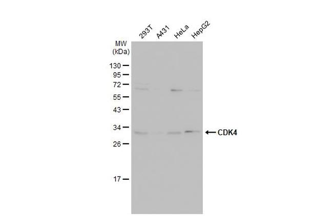 CDK4 Antibody in Western Blot (WB)