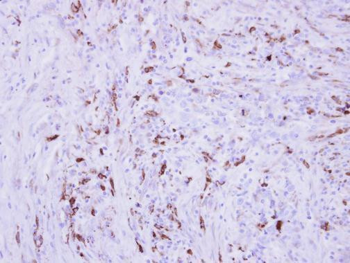 Collagen III Antibody in Immunohistochemistry (Paraffin) (IHC (P))