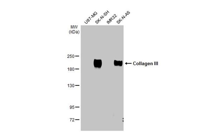 Collagen III Antibody in Western Blot (WB)