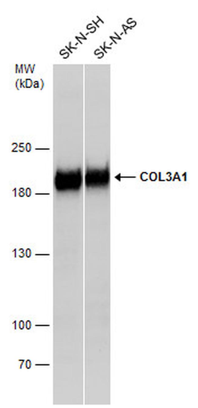 Collagen III Antibody in Western Blot (WB)