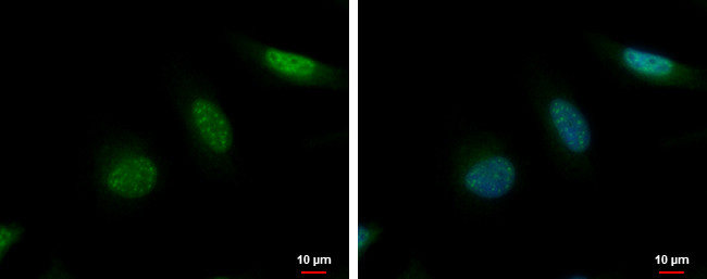 MCAK Antibody in Immunocytochemistry (ICC/IF)