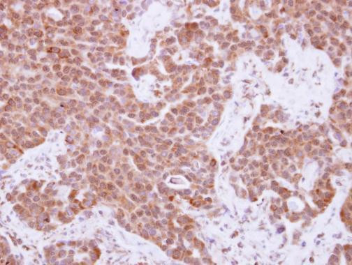 Cyclin A2 Antibody in Immunohistochemistry (Paraffin) (IHC (P))