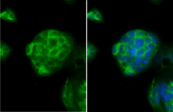 IFNGR1 Antibody in Immunocytochemistry (ICC/IF)