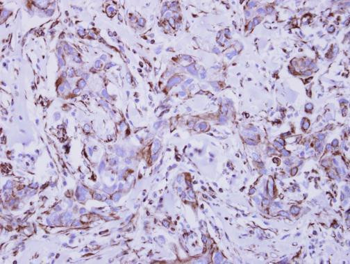 IFNGR1 Antibody in Immunohistochemistry (Paraffin) (IHC (P))