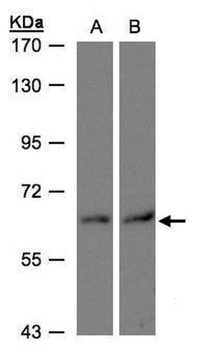 DAK Antibody in Western Blot (WB)