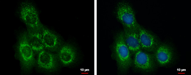 OCRL Antibody in Immunocytochemistry (ICC/IF)