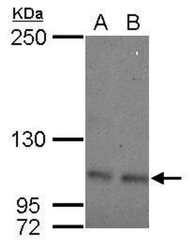 OCRL Antibody in Western Blot (WB)