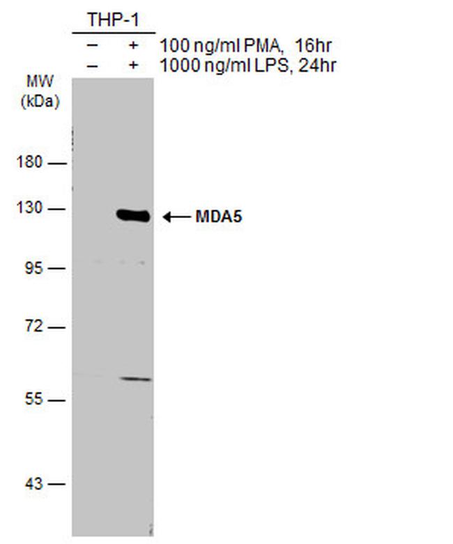 MDA5 Antibody in Western Blot (WB)