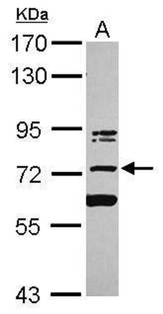 KIAA0020 Antibody in Western Blot (WB)