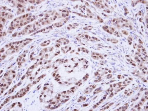 XPA Antibody in Immunohistochemistry (Paraffin) (IHC (P))