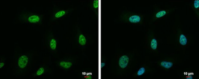 NRF1 Antibody in Immunocytochemistry (ICC/IF)