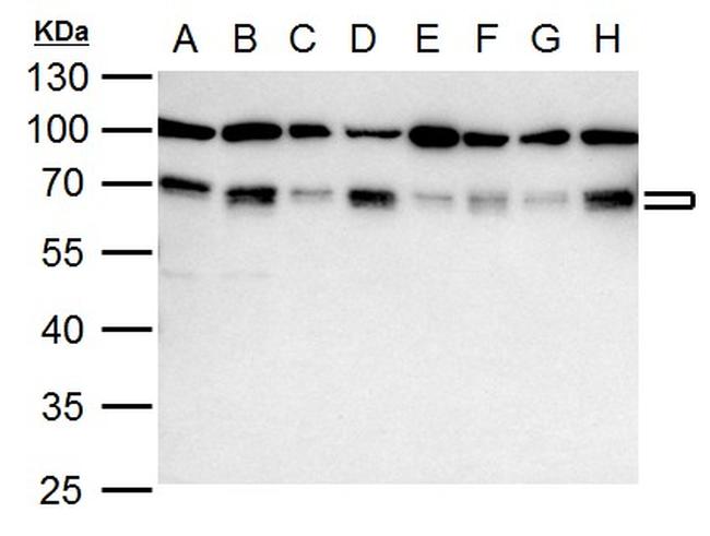 NRF1 Antibody in Western Blot (WB)