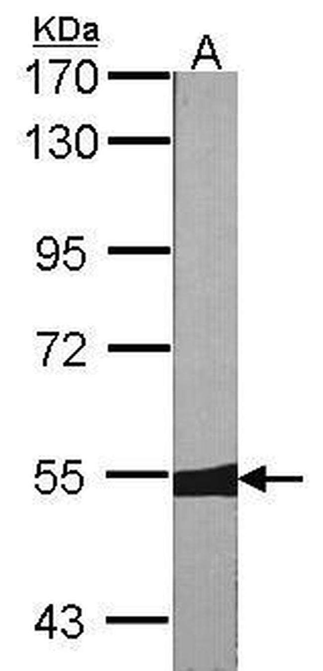 MUTYH Antibody in Western Blot (WB)