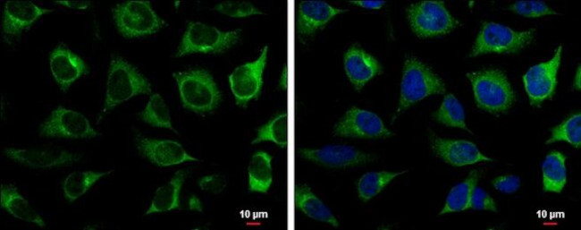 RRM2 Antibody in Immunocytochemistry (ICC/IF)