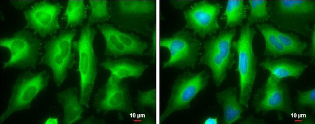 RRM2 Antibody in Immunocytochemistry (ICC/IF)