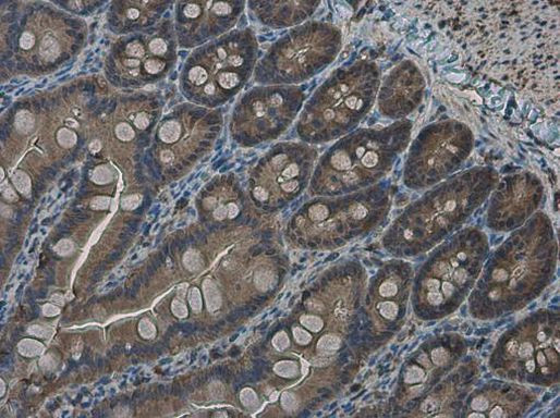 RRM2 Antibody in Immunohistochemistry (Paraffin) (IHC (P))