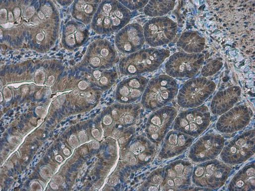 RRM2 Antibody in Immunohistochemistry (Paraffin) (IHC (P))