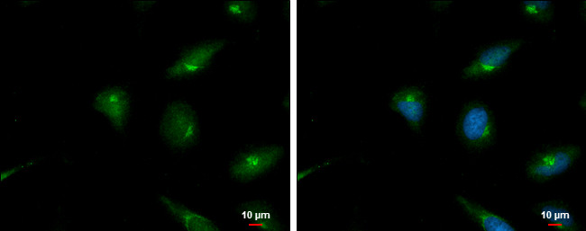 SERPINB2 Antibody in Immunocytochemistry (ICC/IF)