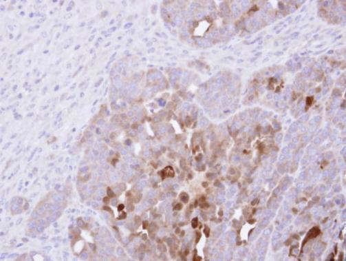 SERPINB2 Antibody in Immunohistochemistry (Paraffin) (IHC (P))