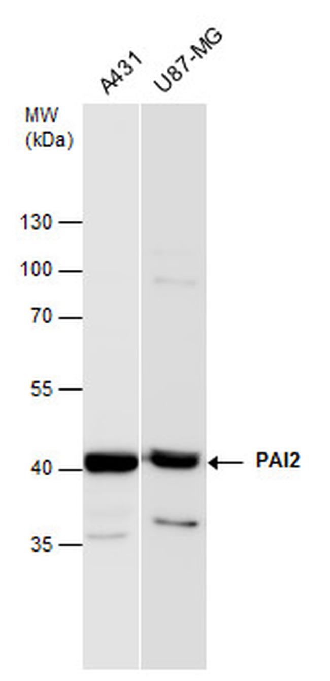 SERPINB2 Antibody in Western Blot (WB)