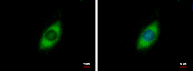 GRP94 Antibody in Immunocytochemistry (ICC/IF)