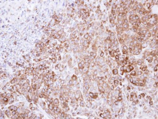 GRP94 Antibody in Immunohistochemistry (Paraffin) (IHC (P))