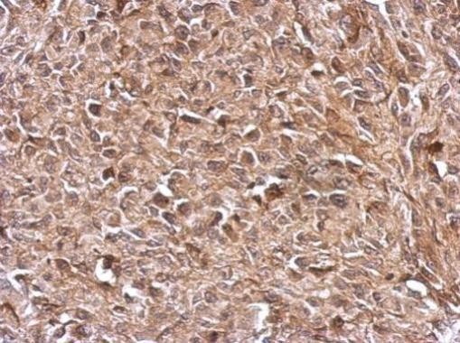 TrxR1 Antibody in Immunohistochemistry (Paraffin) (IHC (P))