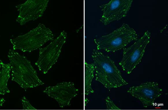 alpha Actinin 2 Antibody in Immunocytochemistry (ICC/IF)