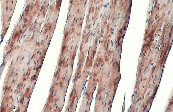 alpha Actinin 2 Antibody in Immunohistochemistry (Paraffin) (IHC (P))