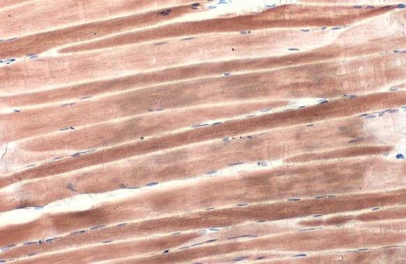 alpha Actinin 2 Antibody in Immunohistochemistry (Paraffin) (IHC (P))