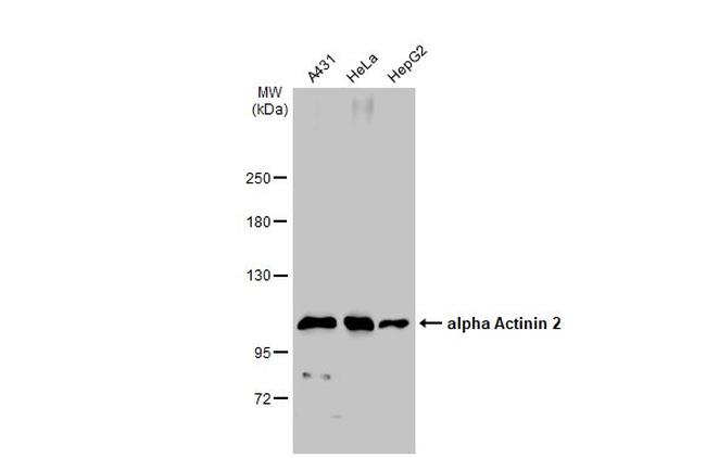 alpha Actinin 2 Antibody in Western Blot (WB)