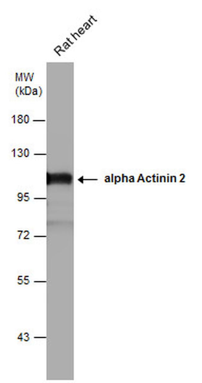 alpha Actinin 2 Antibody in Western Blot (WB)