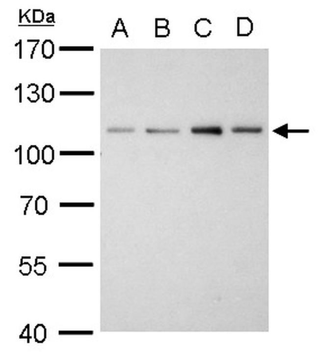 alpha Actinin 2 Antibody in Western Blot (WB)