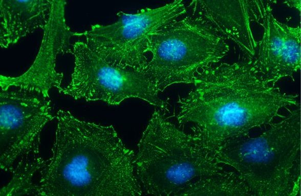 alpha Actinin 2 Antibody in Immunocytochemistry (ICC/IF)