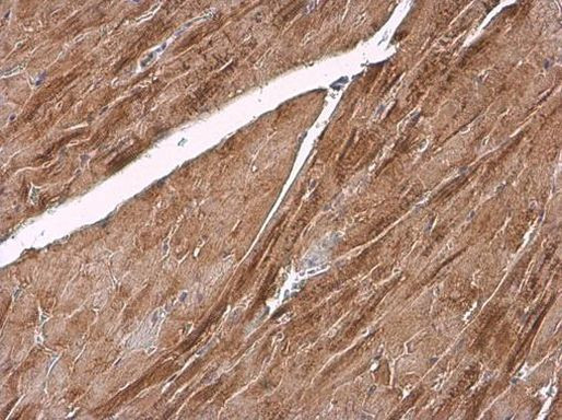 alpha Actinin 2 Antibody in Immunohistochemistry (Paraffin) (IHC (P))